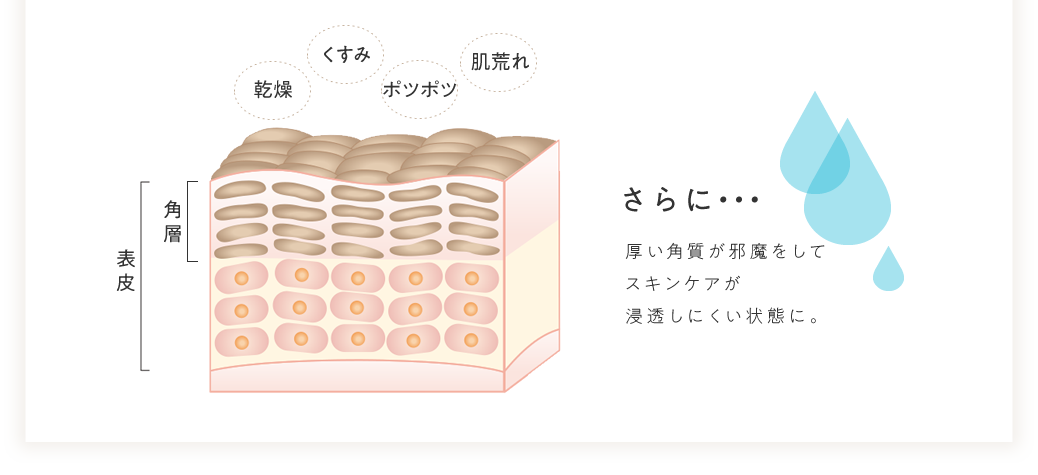 厚い角質が邪魔をしてスキンケアが浸透しにくい状態に